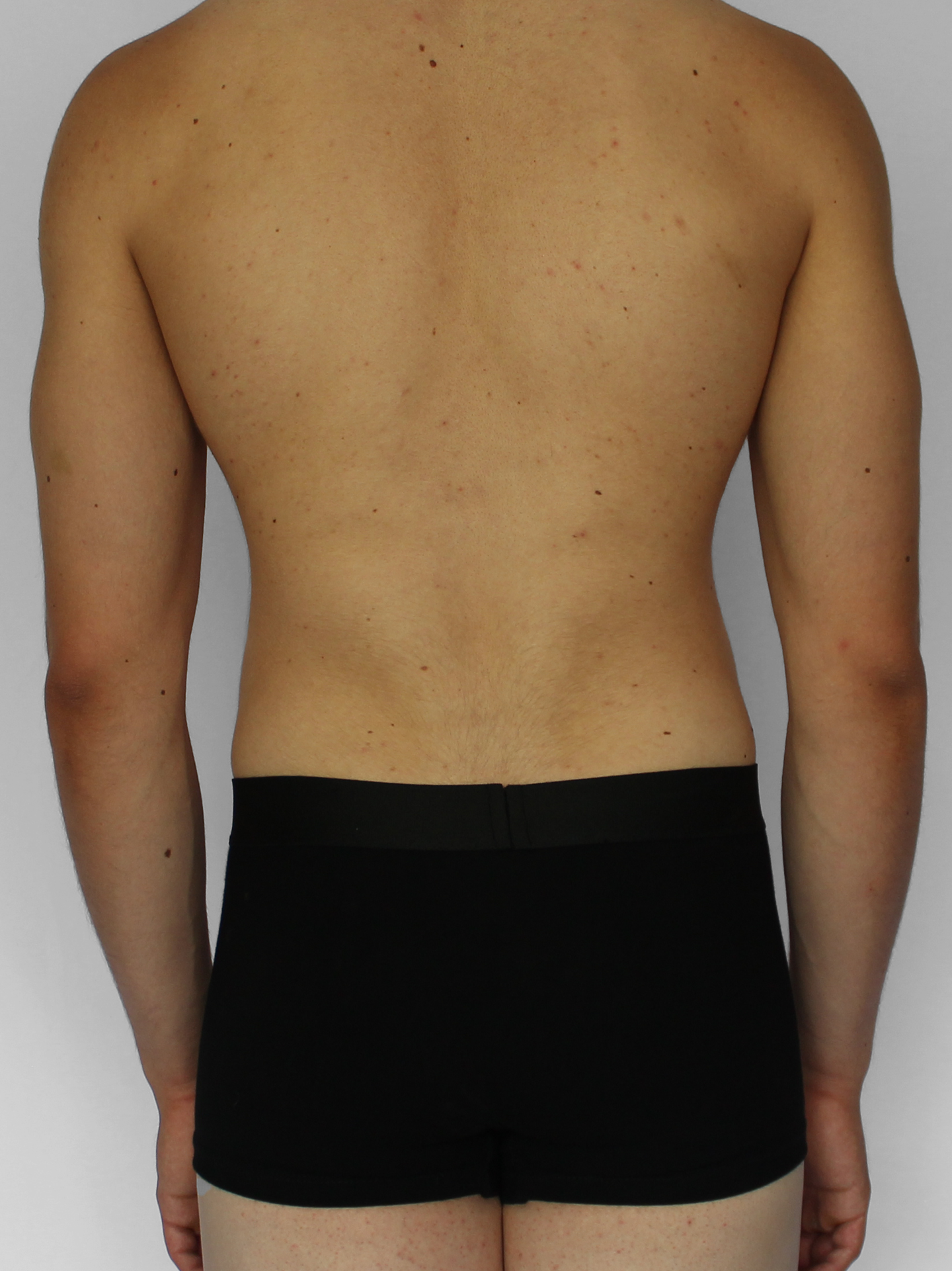 Boxer Black Deluxe SPNDX